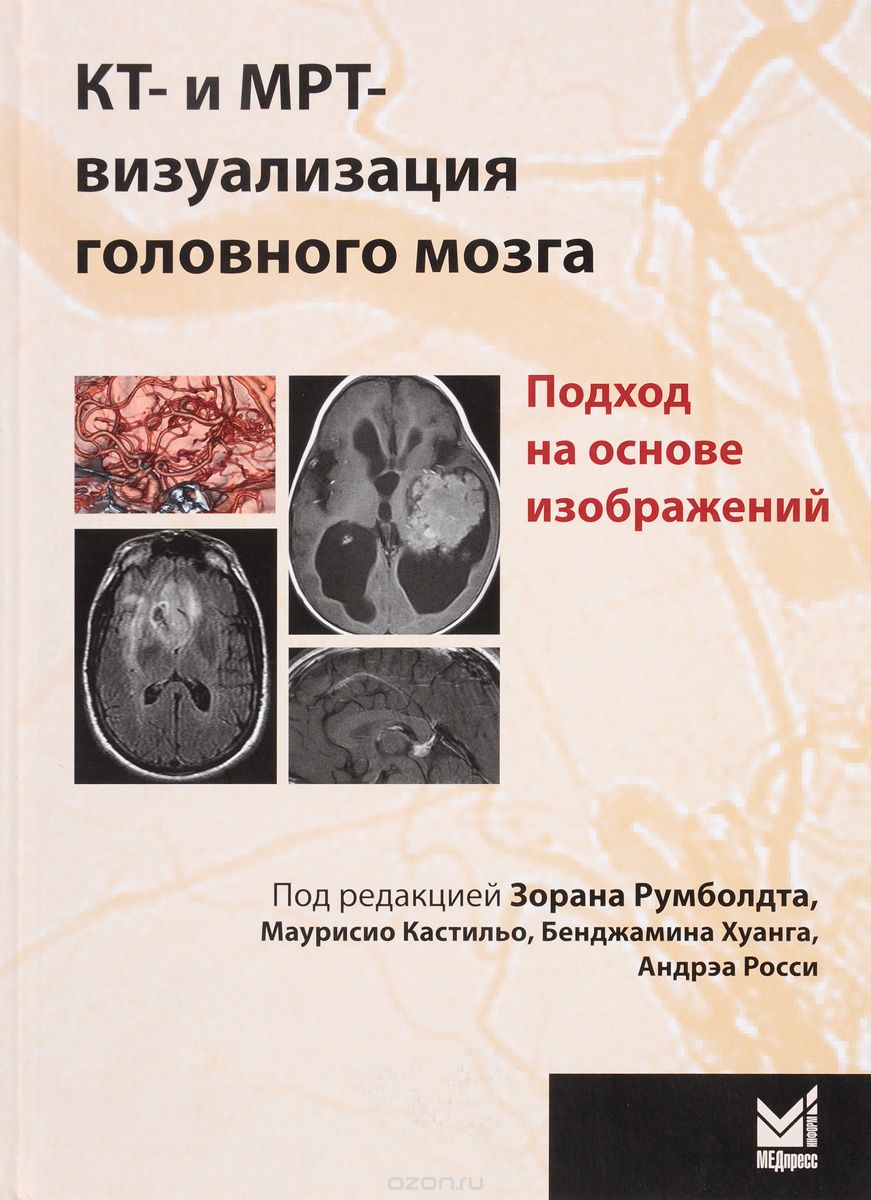 Скачать книгу "КТ- и МРТ-визуализация головного мозга. Подход на основе изображений"