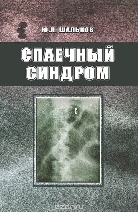 Скачать книгу "Спаечный синдром, Ю. Л. Шальков"